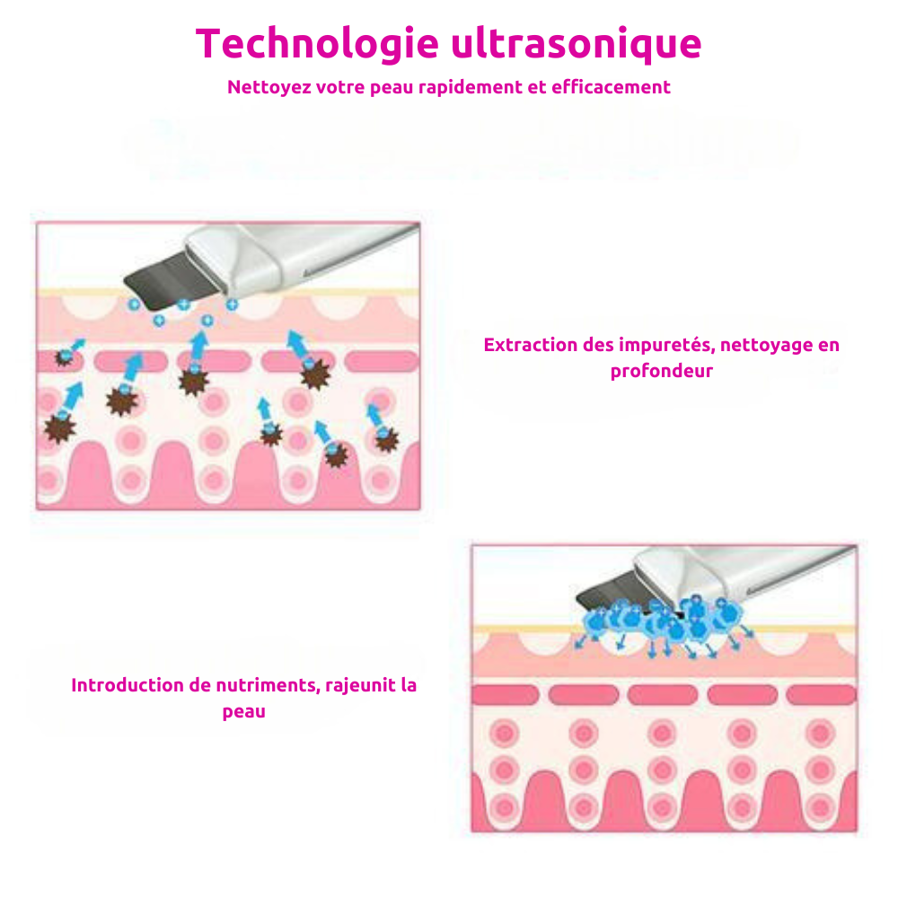 DermiCleanse - Nettoyant visage ultrasons