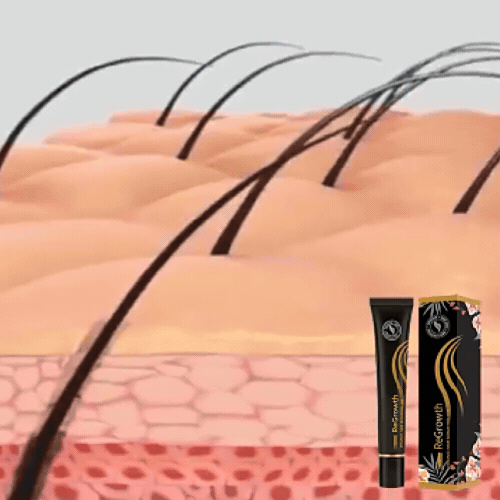 Force Racine - Stimuler la croissance des cheveux naturellement